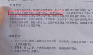 癌症病人做手术针头落体内，院方：建议不取，赔偿在协商中